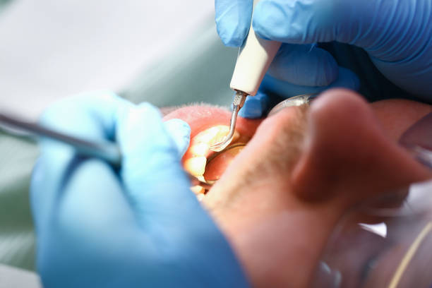 Best Emergency Dental Care for Abscessed Tooth in Higginsville, MO