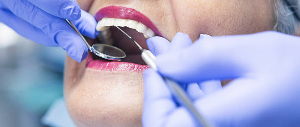 Best Emergency Dentist for Knocked-Out Tooth in Higginsville, MO